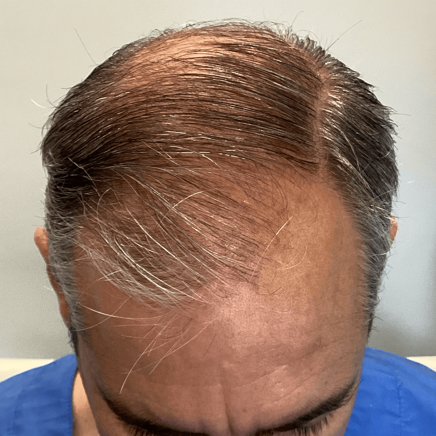 IMG_4653 (1) IMG_4653 (1)