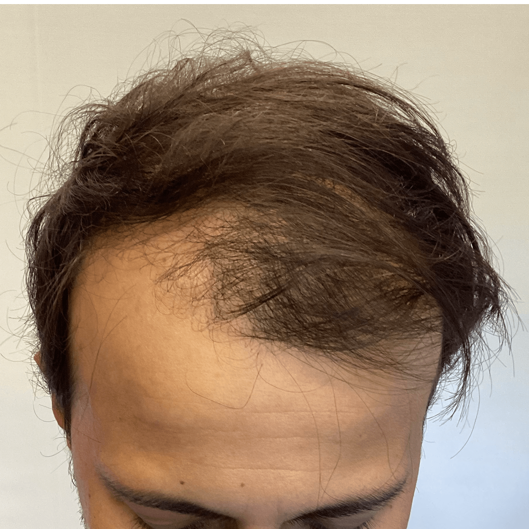 IMG_4823 (1) IMG_4823 (1)